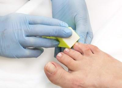 什么情況下需要到修腳加盟店修腳